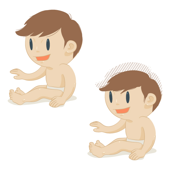 Microcéphalie: les bébés victimes de cette malformation néonatale présentent une taille de tête beaucoup plus petite que celle d'autres bébés du même âge.