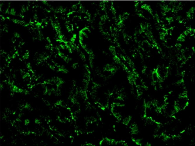 Alexa Fluor® 488-TSA