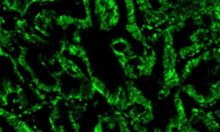 Réactifs Styramide™ iFluor™, pour une amplification du signal améliorée