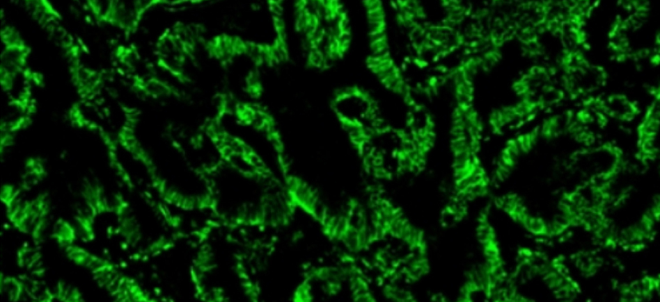 Réactifs Styramide™ iFluor™, pour une amplification du signal améliorée