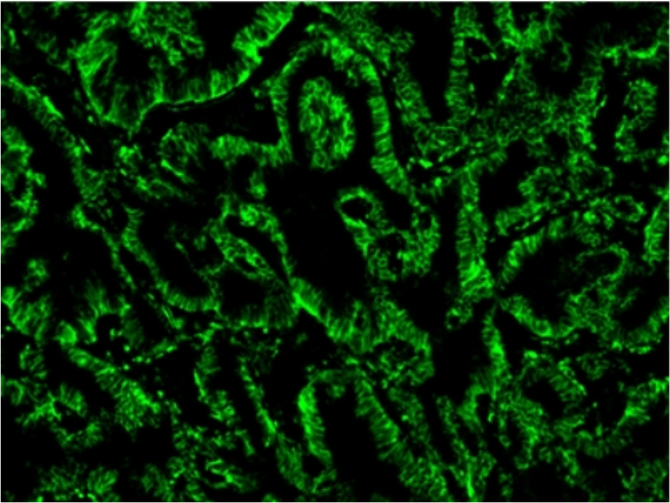 iFluor 488™ PSA™