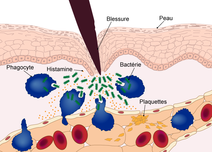 Inflamation blessure