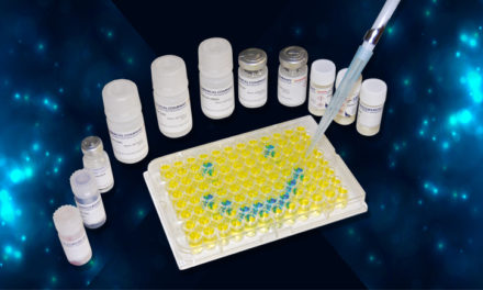 Besoin d’aide dans la réalisation de vos ELISA ?