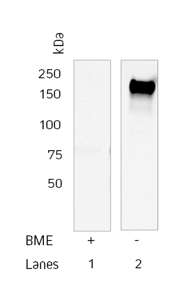Detection_IgE_humaine_purifiee_anticorps_IgE_humaine_conditions_réduites_Jackson_Advion_Interchim_Scientific