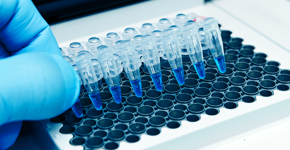 PCR efficace : surmontez les problèmes courants