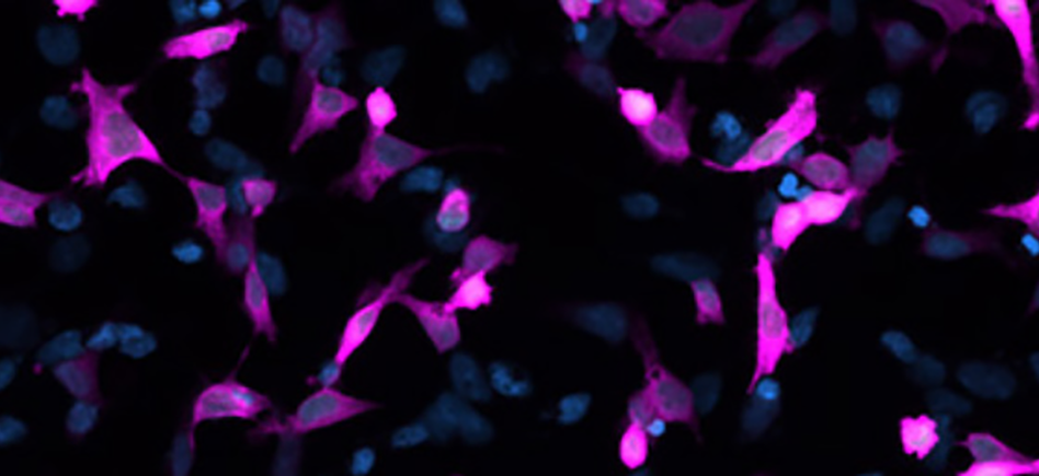 Nouveauté : Détection de la GFP et de ses Dérivés grâce aux Anticorps Jackson Immunoreasearch